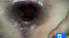 Anal Sex With Hairy Teen